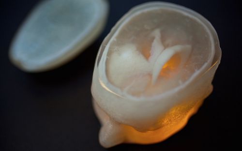 3d printed tumor